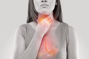 Are Acid Reflux and Heartburn the Same-Revive Hospitals