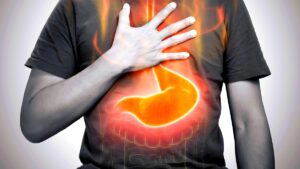 Are Acid Reflux and Heartburn the Same-ReviveHospitals