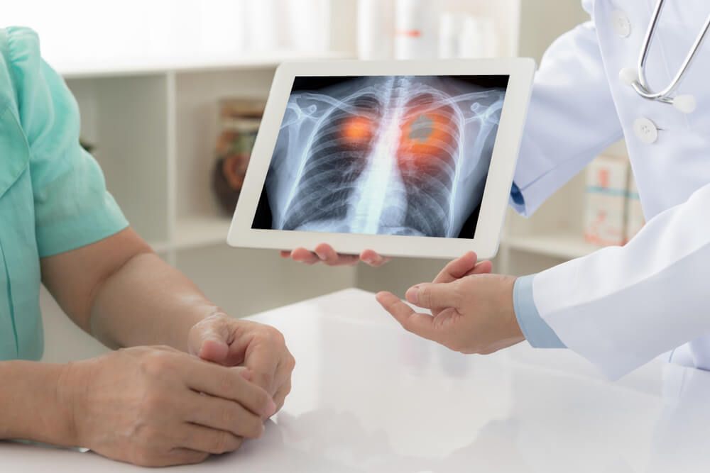 Can a Pulmonologist Detect Lung Disease Early-Revive Hospitals,.