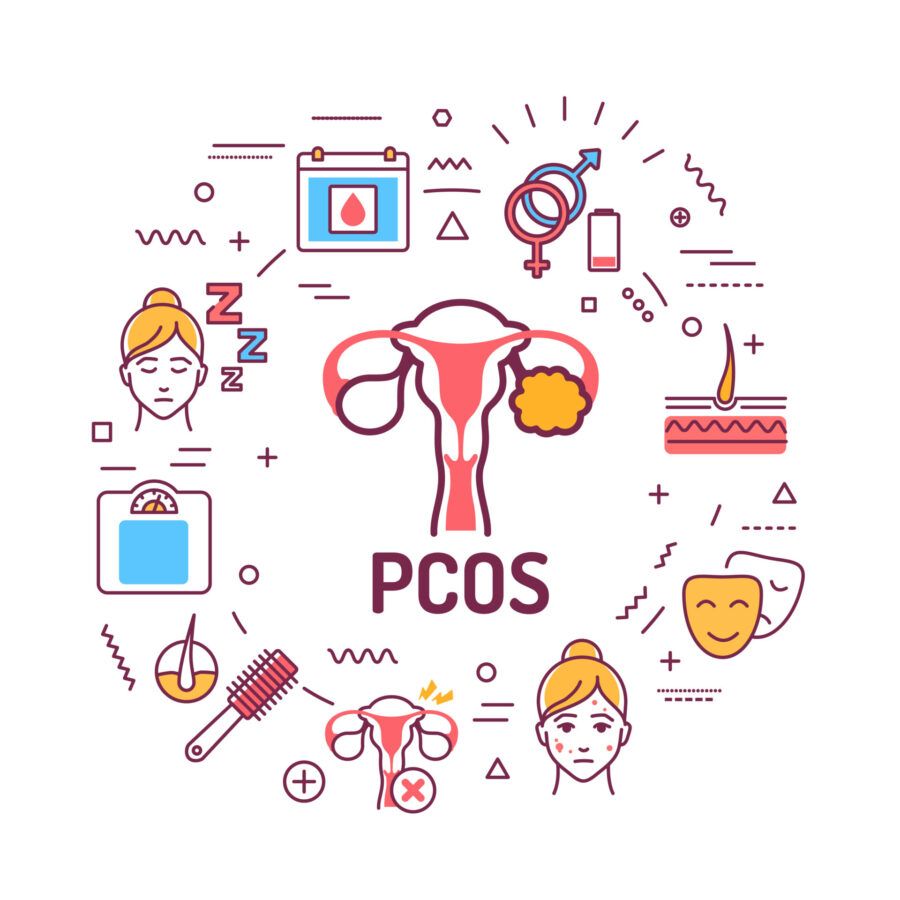 How does PCOS affect menstrual cycles
