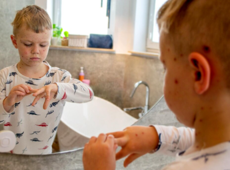 Top 10 Most Common Skin Diseases in Children & Adults -ReviveHospitals-.