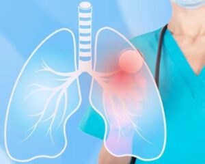 WhatIsaPulmonologistandWhatDoTheyTreat-ReviveHospitals1