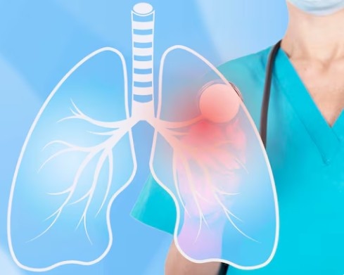 WhatIsaPulmonologistandWhatDoTheyTreat-ReviveHospitals1