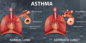 How Pulmonologists Treat COPD and Asthma-Revive Hospital.
