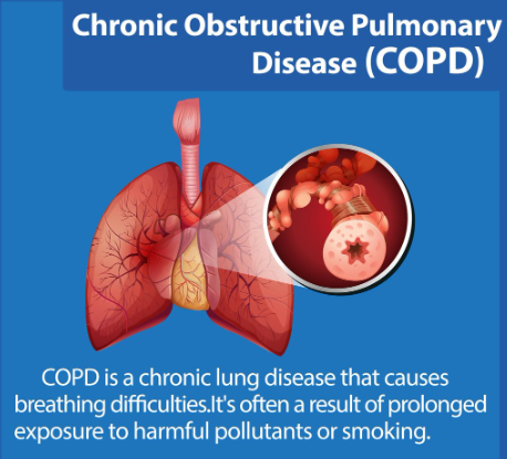 How Pulmonologists Treat COPD and Asthma-Revive Hospital